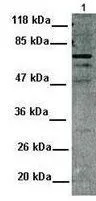 WB analysis of MCF-7 cells using GTX82948 MDM4 antibody at 1:1000.