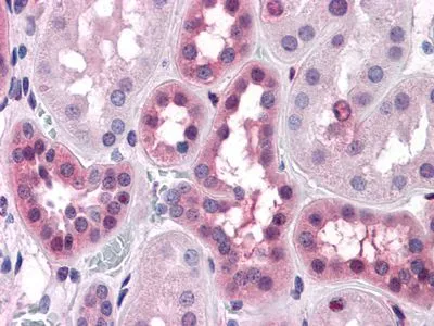 IHC-P analysis of human Liver tissue using GTX83006 ERK1/2 antibody [3F8].