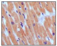 IHC-P analysis of human normal myocardium using GTX83059 BNP antibody [3A6F7C7].