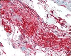 IHC-P analysis of human nerve and ganglion cells using GTX83075 S100A10 antibody [4E7E10].