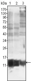 WB analysis of MCF-7 (1), HepG2 (2) and HeLa (3) using GTX83075 S100A10 antibody [4E7E10].