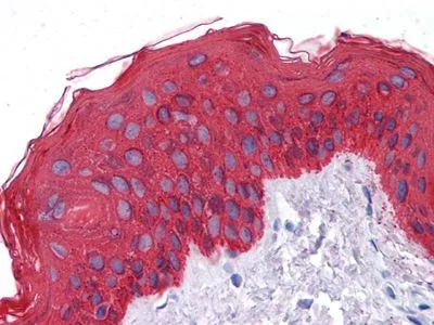 IHC-P analysis of human skin tissue using GTX83079 pan Cytokeratin antibody [7H8C4].