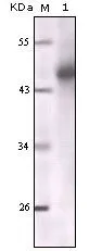 WB analysis of truncated Cytokeratin 5 recombinant protein using GTX83079 pan Cytokeratin antibody [7H8C4].