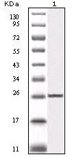 WB analysis of truncated IKBKB recombinant protein using GTX83085 IKK beta antibody [10A2C5B3].