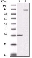WB analysis of truncated IKK beta recombinant protein (1) and K562 cell lysate (2) using GTX83086 IKK beta antibody. WB analysis of truncated IKK beta recombinant protein (1) and K562 cell lysate (2) using GTX83086 IKK beta antibody.