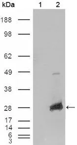 WB analysis of HEK293T cells transfected with the pCMV6-ENTRY control (1) and pCMV6-ENTRY alpha B Crystallin cDNA (2) using GTX83088 alpha B Crystallin antibody [1D11C6E6].