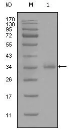 WB analysis of truncated CD45 recombinant protein using GTX83098 CD45 antibody [4A8A4C7A2].