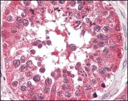 IHC-P analysis of human testis tissue using GTX83134 B-Raf antibody [1H12].
