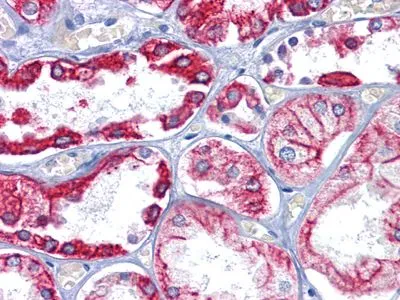 IHC-P analysis of human Kidney tissue using GTX83140 Cytokeratin 8 antibody [8A5D12].