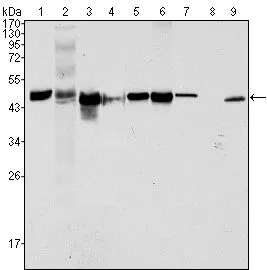 WB analysis of HeLa (1), NIH3T3 (2), A549 (3), Jurkat (4), MCF-7(5), HepG2 (6), A431 (7), HEK293 (8) and K562 (9) cell lysate using GTX83142 Cytokeratin 18 antibody [4D11E4].
