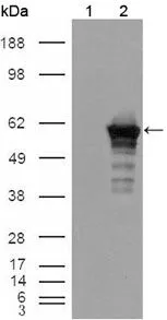 WB analysis of HEK293T cells transfected with the pCMV6-ENTRY control (1) and pCMV6-ENTRY Desmin cDNA (2) using GTX83146 Desmin antibody [10H7D2].