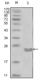 WB analysis of truncated CD10-His recombinant protein using GTX83175 CD10 antibody [3G9D10].