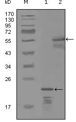 WB analysis of truncated Trx-ERBB3 recombinant protein (1) and MBP-ERBB3 (aa1175-1275) recombinant protein (2) using GTX83178 Her3 / ErbB3 antibody [3F10F6].