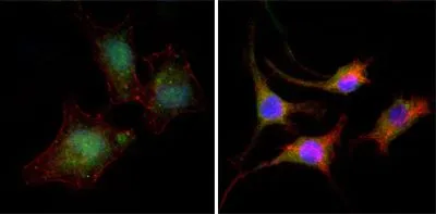 ICC/IF analysis of A549 (left) and SK-BR-3 (right) cells using GTX83185 beta Catenin antibody [4D5]. Green : beta Catenin Blue: DRAQ5 fluorescent DNA dye Red: Actin filaments