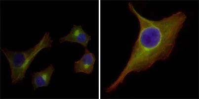 ICC/IF analysis of HepG2(left) and PACN-1 (right) cells using GTX83193 Cytokeratin 15 antibody [6E7]. Green : Cytokeratin 15 Blue: DRAQ5 fluorescent DNA dye Red: Actin filaments