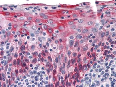 IHC-P analysis of human Tonsil tissue using GTX83193 Cytokeratin 15 antibody [6E7].
