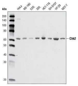 WB analysis of cell lysate from various cell types using GTX83198 Chk2 antibody [1C12B8].