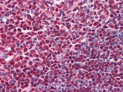 IHC-P analysis of human Tonsil tissue using GTX83206 CD20 antibody [3E9D3C1G3].