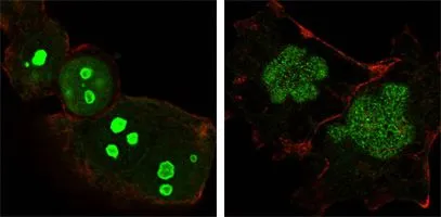 ICC/IF analysis of HeLa (left) and NTERA-2 (right) cells using GTX83217 Nucleophosmin antibody [7H10B9]. Green : Nucleophosmin Red: Actin filaments