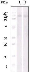WB analysis of Jurkat (1) and NIH3T3 (2) cell lysate using GTX83219 EphB6 antibody [8E7H12].