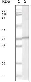 WB analysis of KSHV ORF62 recombinant protein using GTX83235 KSHV ORF62 antibody [5B7B6].