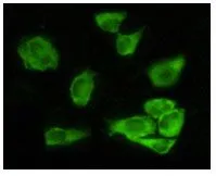 ICC/IF analysis of HeLa cells using GTX83246 GSK3 alpha antibody [9D5G1]. Green : GSK3 alpha