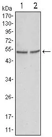 ICC/IF analysis of HeLa cells using GTX83246 GSK3 alpha antibody [9D5G1]. Green : GSK3 alpha