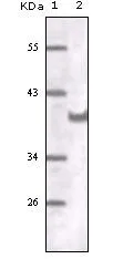 WB analysis of truncated CD31 recombinant protein using GTX83248 CD31 antibody [2F7B2].