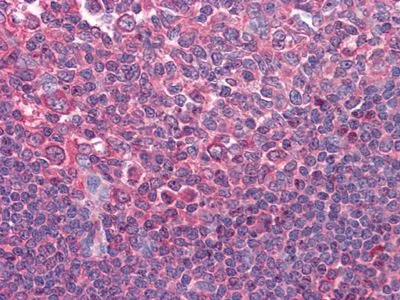 IHC-P analysis of human Tonsil tissue using GTX83265 CD80 antibody [2A2].