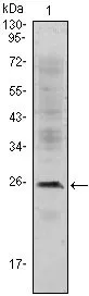 WB analysis of Jurkat cell lysate using GTX83278 CD3 epsilon antibody [4E2].
