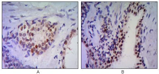 IHC-P analysis of human prostata tissue (A, B) using GTX83288 Nkx3.1 antibody [4H4].