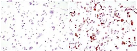 ICC/IF analysis of HCC827 cells, untransfected (left) or transfected with GFP (right) using GTX83292 GFP antibody [4B10B2].