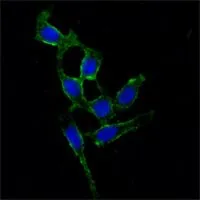 ICC/IF analysis of A549 cells using GTX83323 FAK antibody [10H7E9]. Green : FAK Blue: DRAQ5 fluorescent DNA dye
