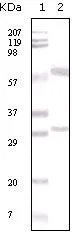 WB analysis of human breast carcinoma tissue lysate using GTX83349 Estrogen Receptor alpha antibody [2B7].
