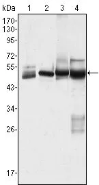 WB analysis of HeLa (1), MCF-7 (2), A431 (3) and A549 (4) cell lysate using GTX83354 Cytokeratin 7 antibody [5D12].