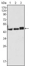 WB analysis of HeLa (1), MCF-7 (2) and A431 (3) cell lysate using GTX83366 Cytokeratin 17 antibody [3B12].