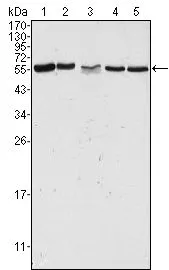 WB analysis of HeLa (1), Jurkat (2), A549 (3), HEK293 (4) and K562 (5) cell lysate using GTX83373 PAK2 antibody [3B5].
