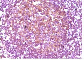 IHC-P analysis of human lymphnode using GTX83395 CD14 antibody [5A3].