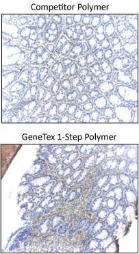 GeneTex One Step polymer outperforms similar products from other companies.