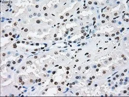 IHC-P analysis of kidney tissue using GTX83406 XRCC4 antibody [4H9]. Antigen retrieval : Heat-induced epitope retrieval by 10mM citrate buffer, pH6.0, 100oC for 10min. Dilution : 1:50