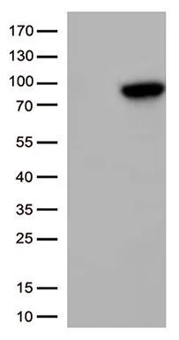 WB analysis of HEK293T cells transfected with XRCC1 plasmid (Right) or empty vector (Left) for 48 hrs using GTX83410 XRCC1 antibody [2G8]. Loading : 5 ug per lane