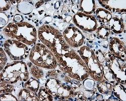 IHC-P analysis of human kidney tissue using GTX83411 XRCC1 antibody [2D8]. Antigen retrieval : Heat-induced epitope retrieval by 10mM citrate buffer, pH6.0, 100oC for 10min.