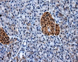 IHC-P analysis of human pancreas tissue using GTX83411 XRCC1 antibody [2D8]. Antigen retrieval : Heat-induced epitope retrieval by 10mM citrate buffer, pH6.0, 100oC for 10min.