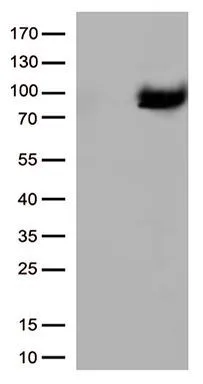 WB analysis of HEK293T cells transfected with XRCC1 plasmid (Right) or empty vector (Left) for 48 hrs using GTX83411 XRCC1 antibody [2D8]. Loading : 5 ug per lane