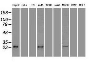 WB analysis of various cell lines using GTX83425 VEGFA antibody [4G3]. Loading : 35 ug per lane