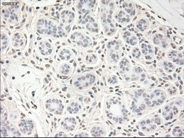 IHC-P analysis of human breast tissue using GTX83426 VEGFA antibody [4E3]. Antigen retrieval : Heat-induced epitope retrieval by 10mM citrate buffer, pH6.0, 100oC for 10min.