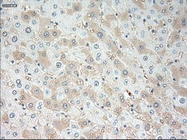 IHC-P analysis of human liver tissue using GTX83426 VEGFA antibody [4E3]. Antigen retrieval : Heat-induced epitope retrieval by 10mM citrate buffer, pH6.0, 100oC for 10min.