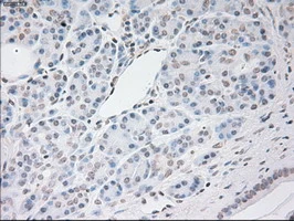 IHC-P analysis of human pancreas tissue using GTX83426 VEGFA antibody [4E3]. Antigen retrieval : Heat-induced epitope retrieval by 10mM citrate buffer, pH6.0, 100oC for 10min.