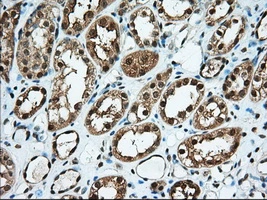 IHC-P analysis of human kidney tissue using GTX83430 USP5 antibody [2H5]. Antigen retrieval : Heat-induced epitope retrieval by 10mM citrate buffer, pH6.0, 100oC for 10min. Dilution : 1:50
