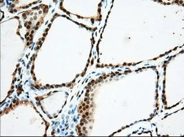 IHC-P analysis of human thyroid tissue using GTX83430 USP5 antibody [2H5]. Antigen retrieval : Heat-induced epitope retrieval by 10mM citrate buffer, pH6.0, 100oC for 10min. Dilution : 1:50